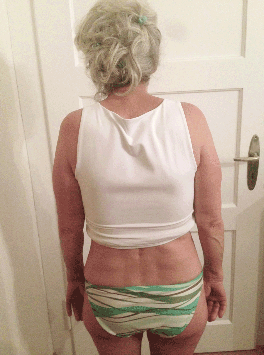 FrauHinten_vorher_nachher