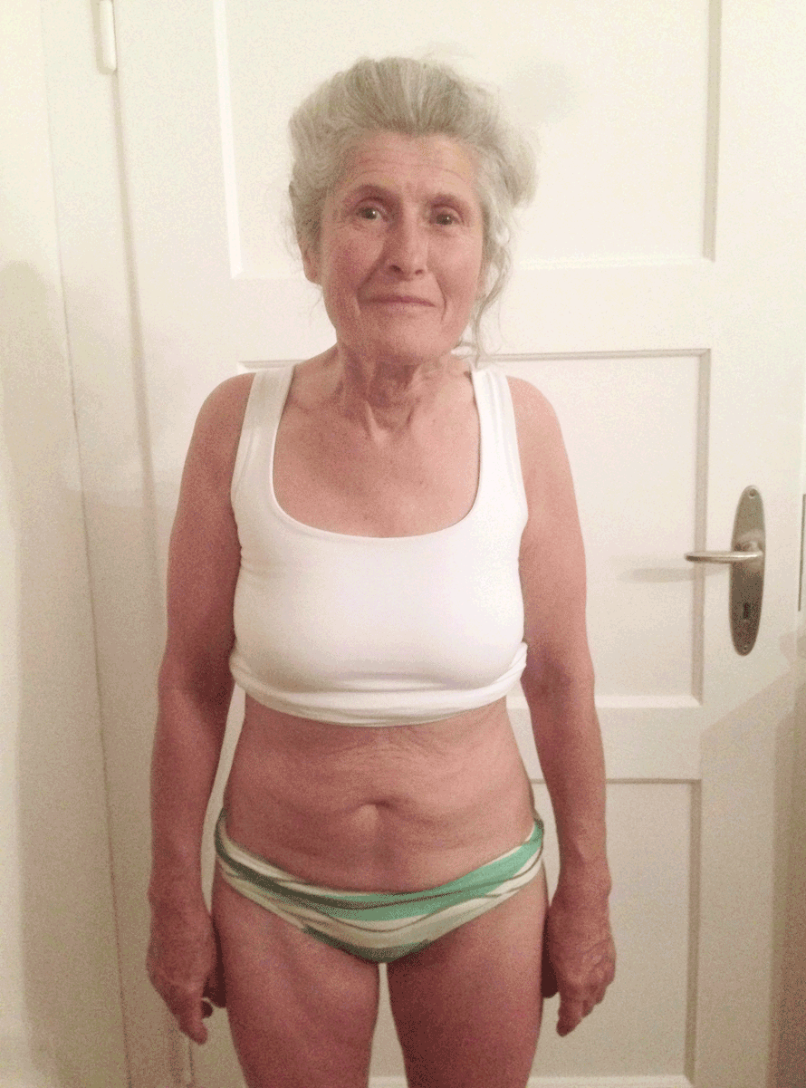 FrauVorne_vorher_nachher